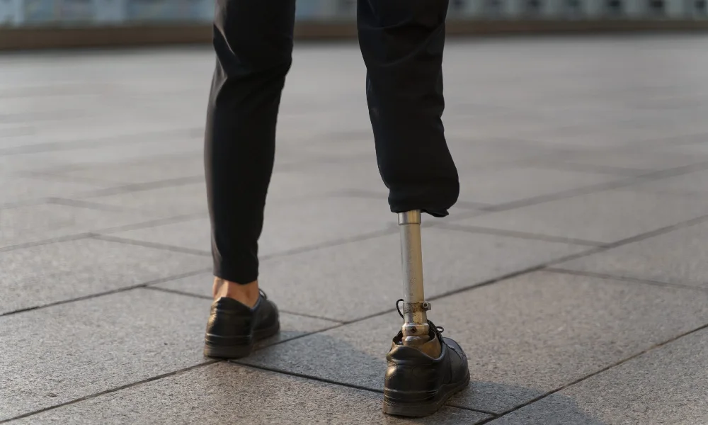 disabled person with amputee leg